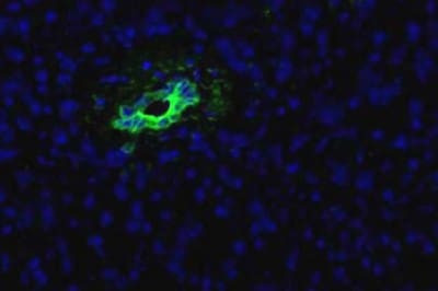 PDCD2 Antibody in Immunocytochemistry (ICC/IF)