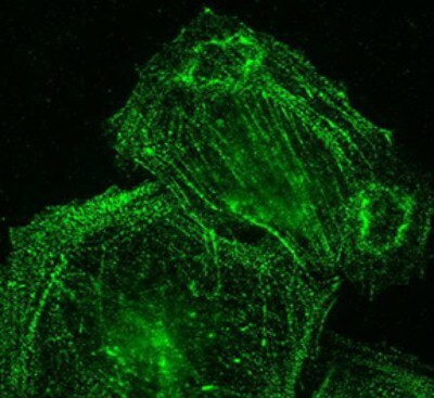 Palladin Antibody in Immunocytochemistry (ICC/IF)