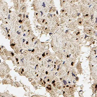 Palladin Antibody in Immunohistochemistry (Paraffin) (IHC (P))