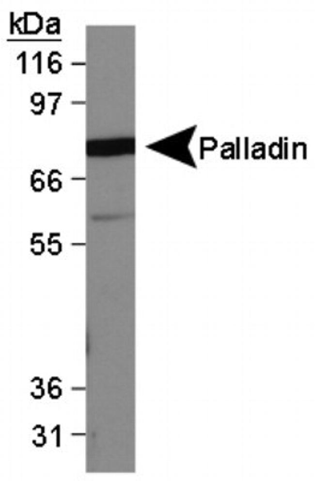 Palladin Antibody in Western Blot (WB)