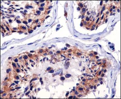 TFAM Antibody in Immunohistochemistry (Paraffin) (IHC (P))