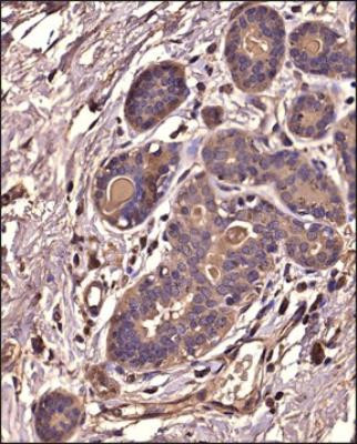 IkB alpha Antibody in Immunohistochemistry (Paraffin) (IHC (P))