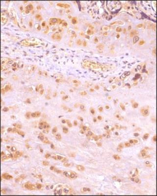 IKK beta Antibody in Immunohistochemistry (Paraffin) (IHC (P))