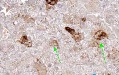 CD254 (RANK Ligand) Antibody in Immunohistochemistry (Paraffin) (IHC (P))