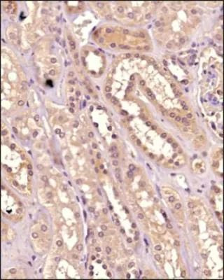 IKK alpha Antibody in Immunohistochemistry (Paraffin) (IHC (P))