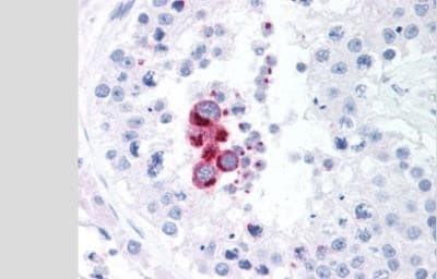 TBK1 Antibody in Immunohistochemistry (Paraffin) (IHC (P))