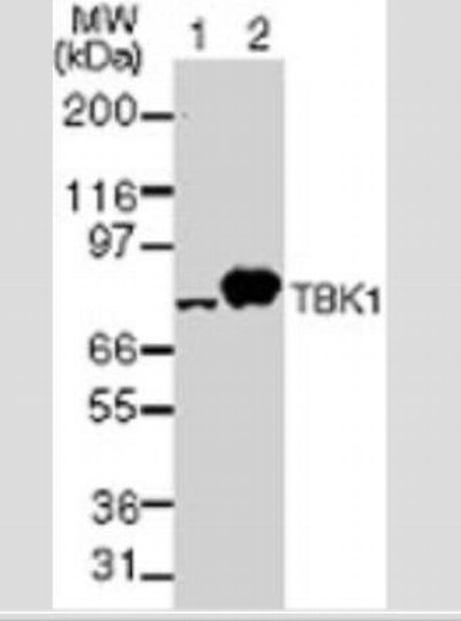 TBK1 Antibody in Western Blot (WB)