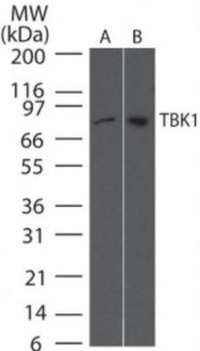 TBK1 Antibody in Western Blot (WB)