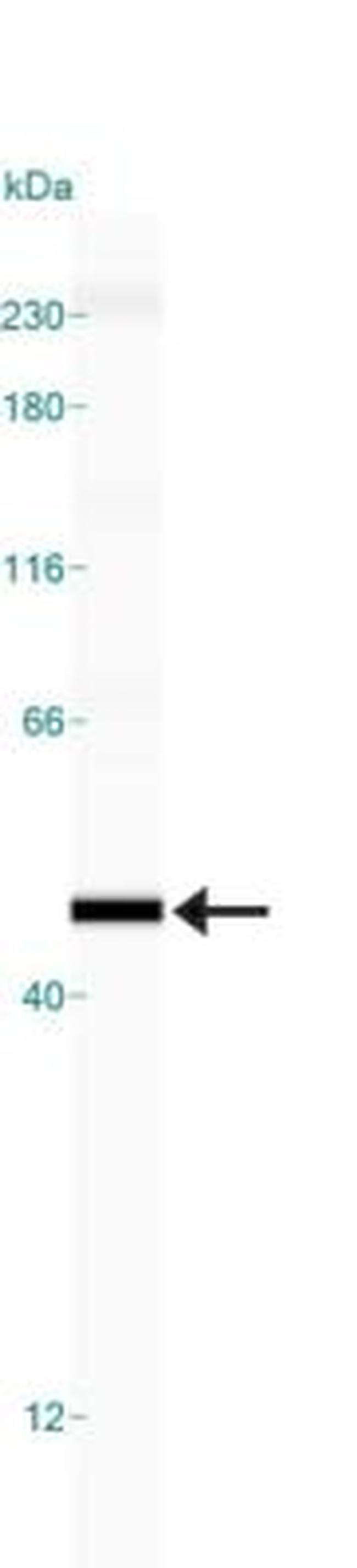 p73 Antibody in Western Blot (WB)