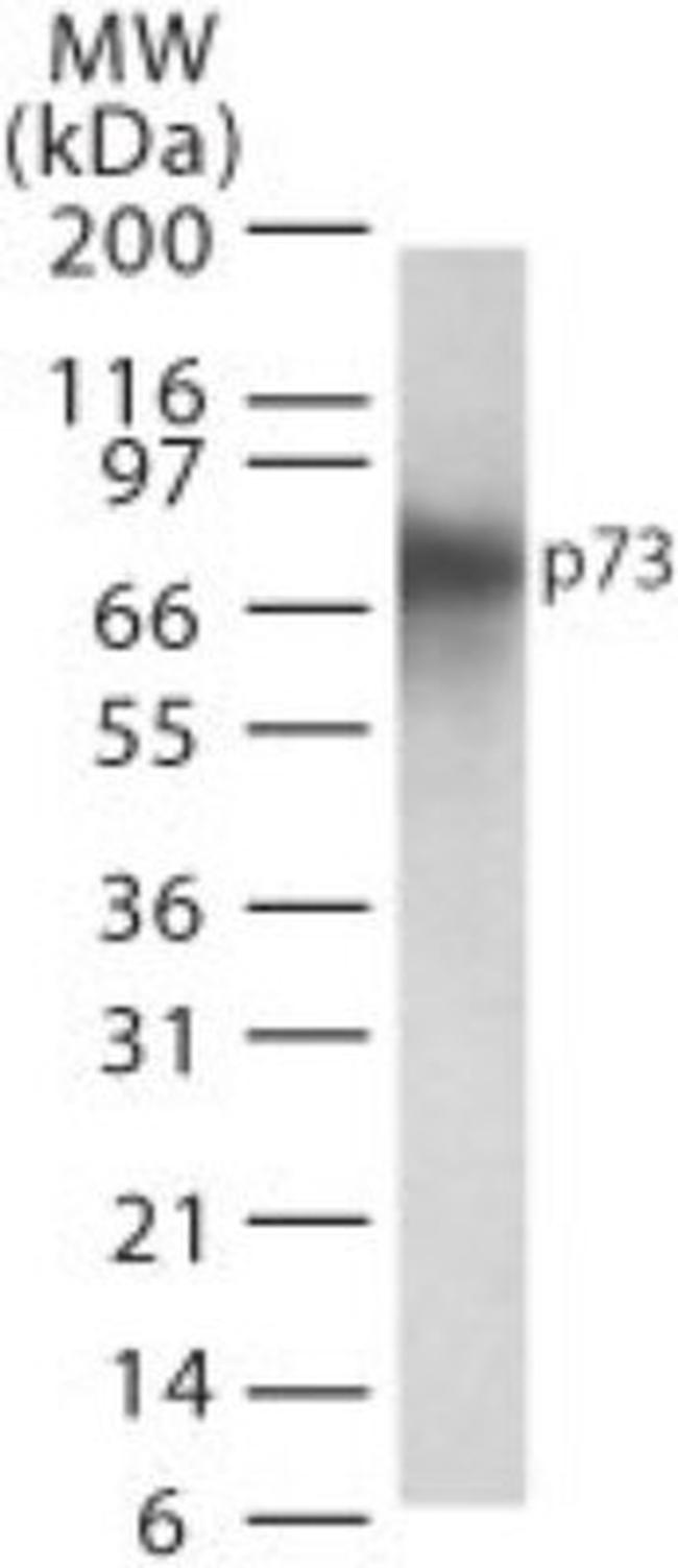 p73 Antibody in Western Blot (WB)