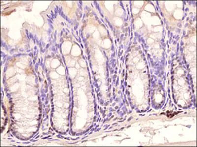 TLR3 Antibody in Immunohistochemistry (Paraffin) (IHC (P))