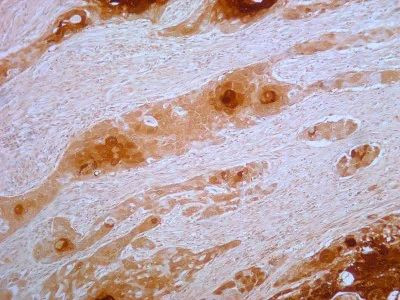 S100A7 Antibody in Immunohistochemistry (Paraffin) (IHC (P))