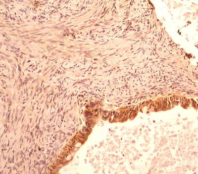 Caspase 1 Antibody in Immunohistochemistry (Paraffin) (IHC (P))