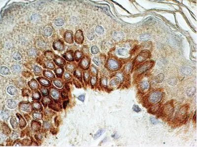 TLR4 Antibody in Immunohistochemistry (Paraffin) (IHC (P))