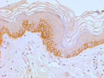 TLR4 Antibody in Immunohistochemistry (Paraffin) (IHC (P))