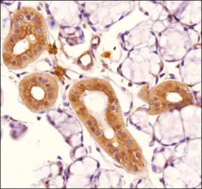 TLR4 Antibody in Immunohistochemistry (Paraffin) (IHC (P))