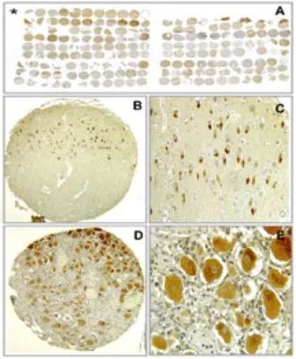 Bi-1 Antibody in Immunohistochemistry (Paraffin) (IHC (P))