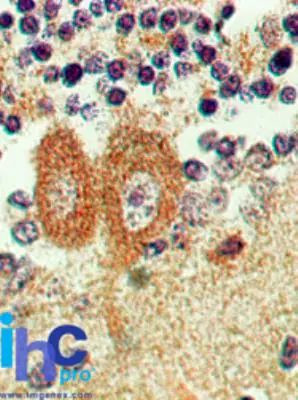 Bi-1 Antibody in Immunohistochemistry (Paraffin) (IHC (P))