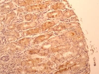 IL-17F Antibody in Immunohistochemistry (Paraffin) (IHC (P))