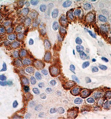 TLR5 Antibody in Immunohistochemistry (Paraffin) (IHC (P))