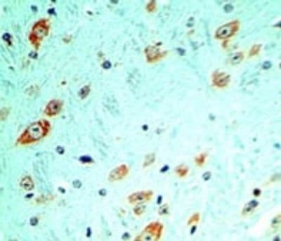 TLR5 Antibody in Immunohistochemistry (Paraffin) (IHC (P))