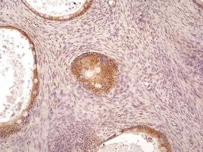 AGR2 Antibody in Immunohistochemistry (Paraffin) (IHC (P))