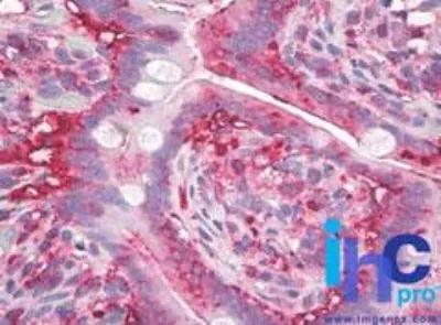 AGR2 Antibody in Immunohistochemistry (Paraffin) (IHC (P))