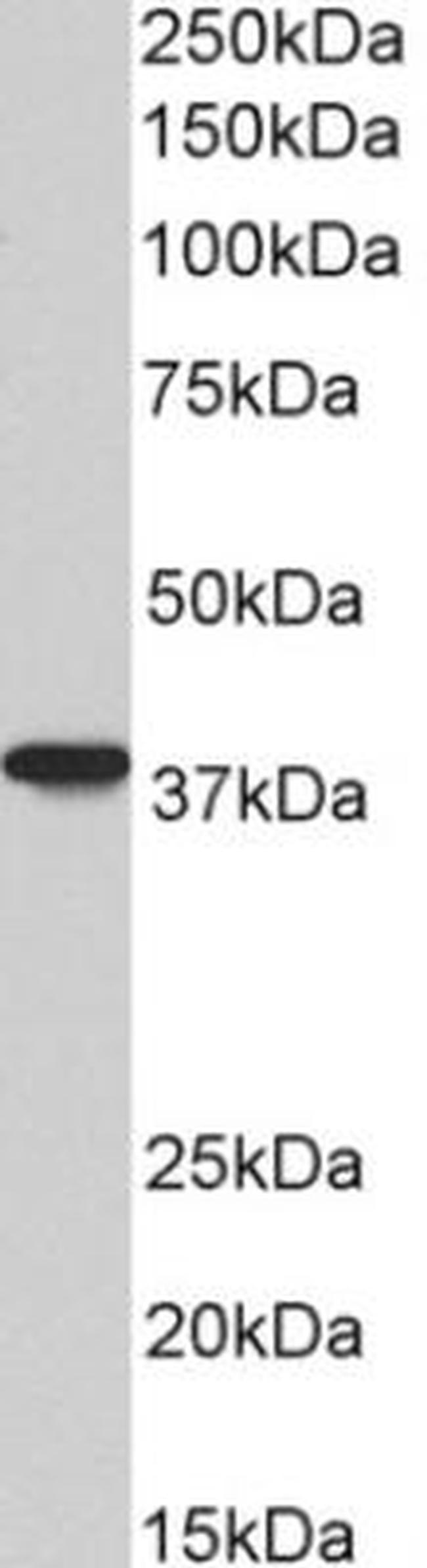 AIM2 Antibody in Western Blot (WB)