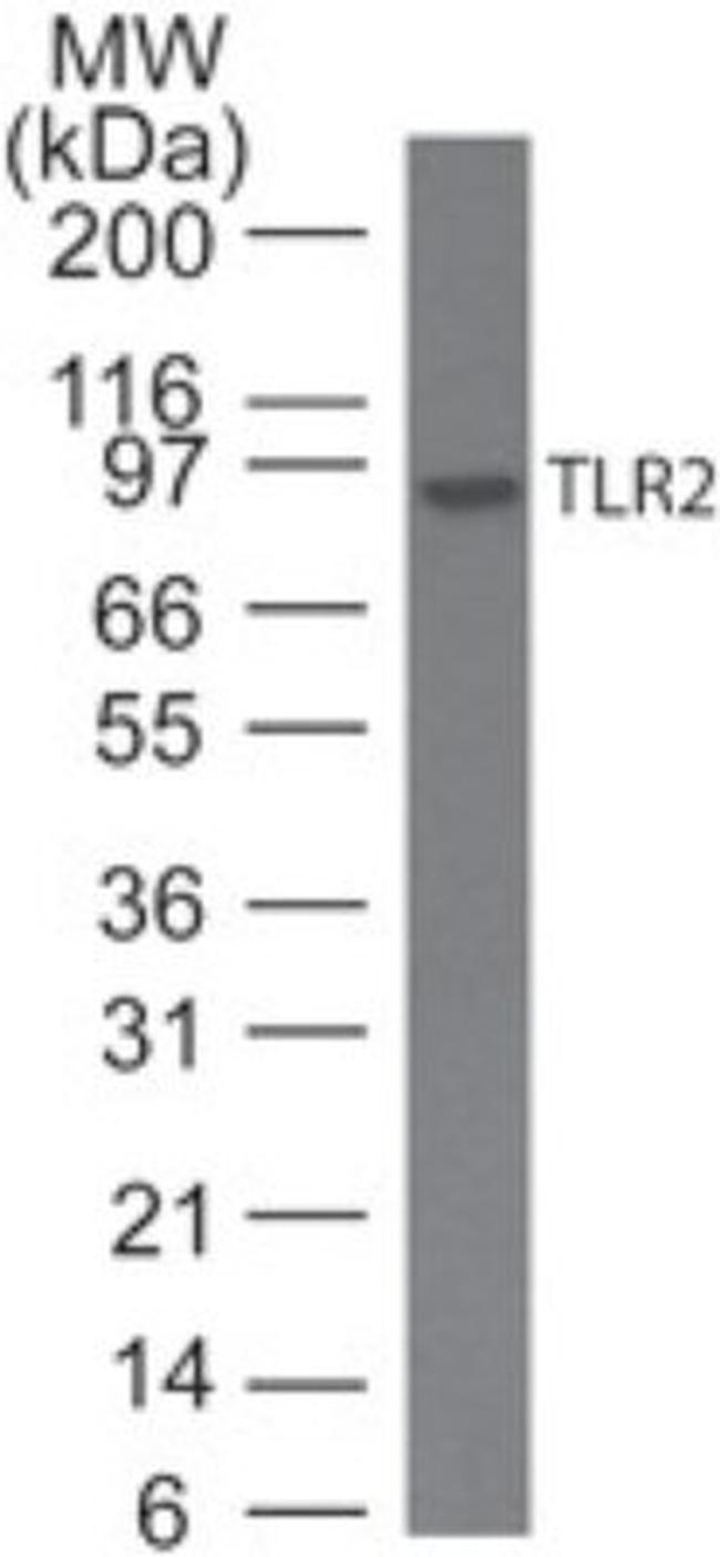 TLR2 Antibody in Western Blot (WB)