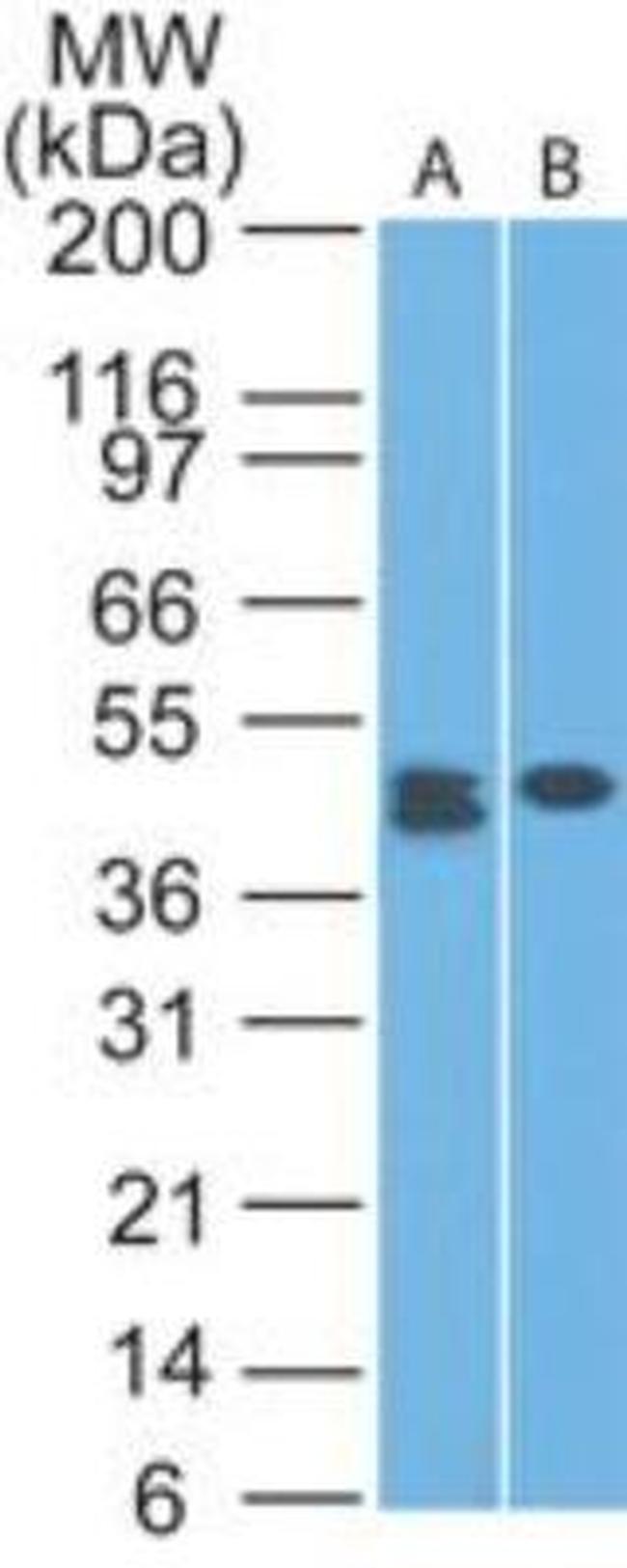 CLEC9A Antibody in Western Blot (WB)