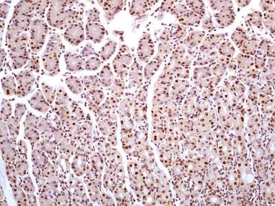 HMGB1 Antibody in Immunohistochemistry (Paraffin) (IHC (P))