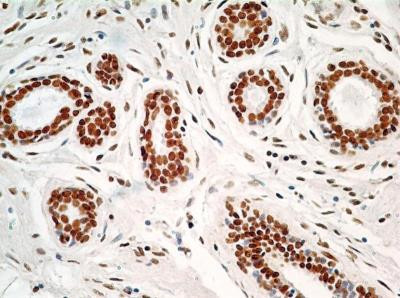 HMGB1 Antibody in Immunohistochemistry (Paraffin) (IHC (P))