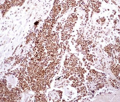 HMGB1 Antibody in Immunohistochemistry (Paraffin) (IHC (P))