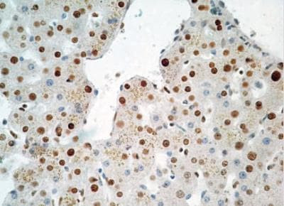 HMGB1 Antibody in Immunohistochemistry (Paraffin) (IHC (P))