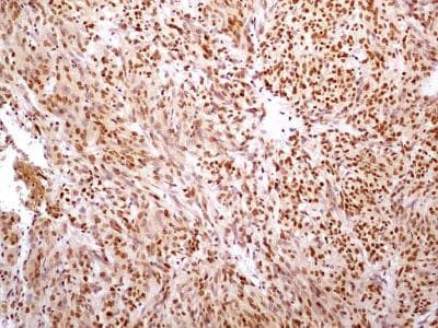 HMGB1 Antibody in Immunohistochemistry (Paraffin) (IHC (P))