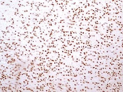 HMGB1 Antibody in Immunohistochemistry (Paraffin) (IHC (P))