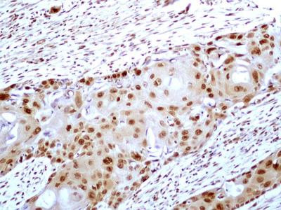 HMGB1 Antibody in Immunohistochemistry (Paraffin) (IHC (P))