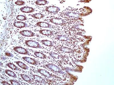 HMGB1 Antibody in Immunohistochemistry (Paraffin) (IHC (P))