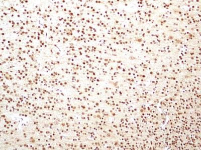 HMGB1 Antibody in Immunohistochemistry (Paraffin) (IHC (P))