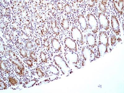 HMGB1 Antibody in Immunohistochemistry (Paraffin) (IHC (P))