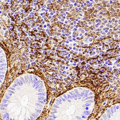 Podoplanin Antibody in Immunohistochemistry (Paraffin) (IHC (P))