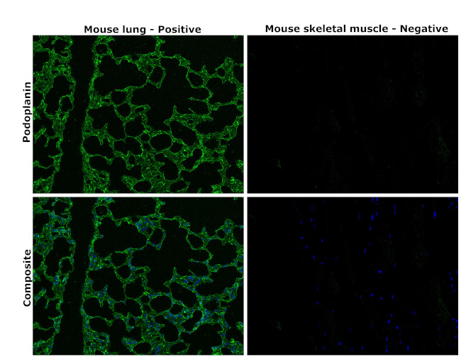 Podoplanin Antibody in Immunohistochemistry (Paraffin) (IHC (P))