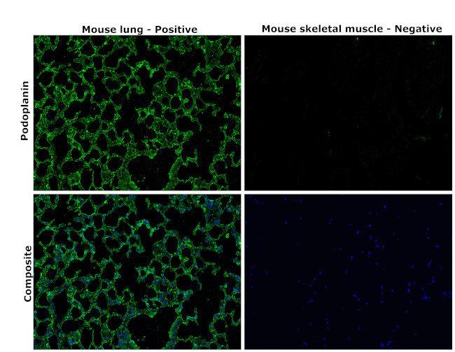 Podoplanin Antibody in Immunohistochemistry (Paraffin) (IHC (P))