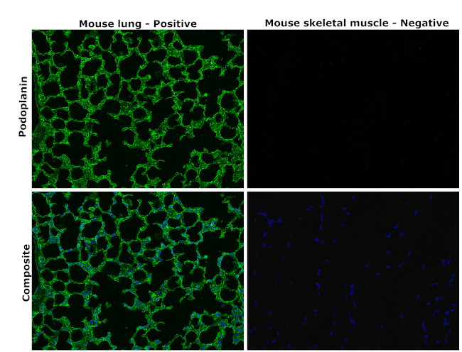 Podoplanin Antibody in Immunohistochemistry (Paraffin) (IHC (P))