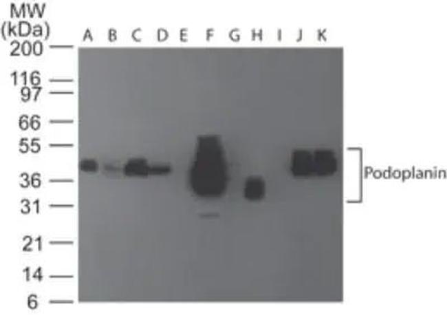 Podoplanin Antibody in Western Blot (WB)