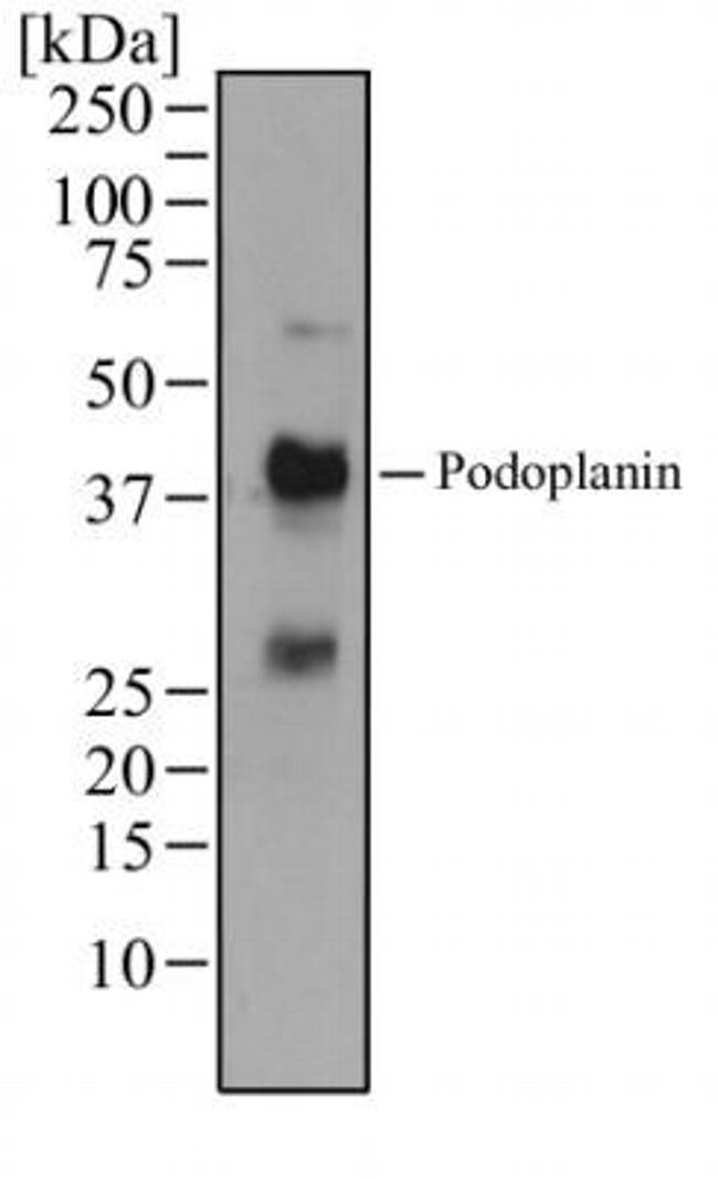 Podoplanin Antibody in Western Blot (WB)