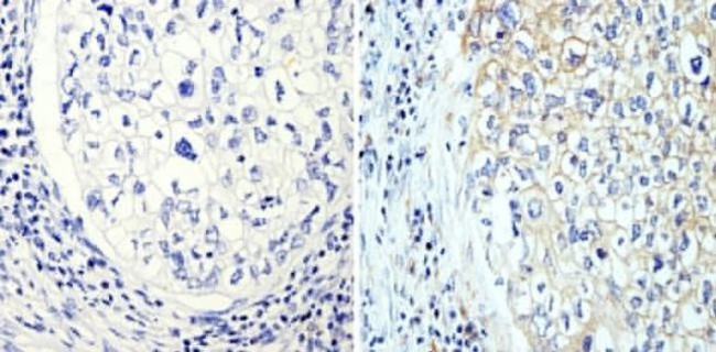 beta Tubulin Loading Control Antibody in Immunohistochemistry (Paraffin) (IHC (P))