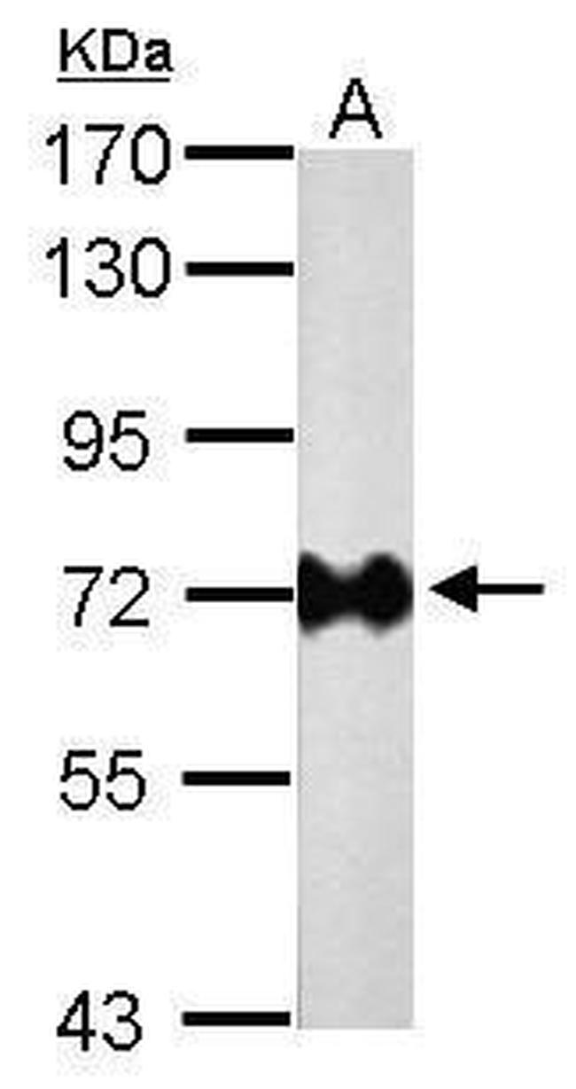 Helicobacter pylori Urease B Antibody in Western Blot (WB)