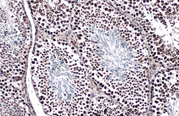 TET1 Antibody in Immunohistochemistry (Paraffin) (IHC (P))