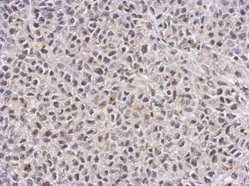 TET1 Antibody in Immunohistochemistry (Paraffin) (IHC (P))